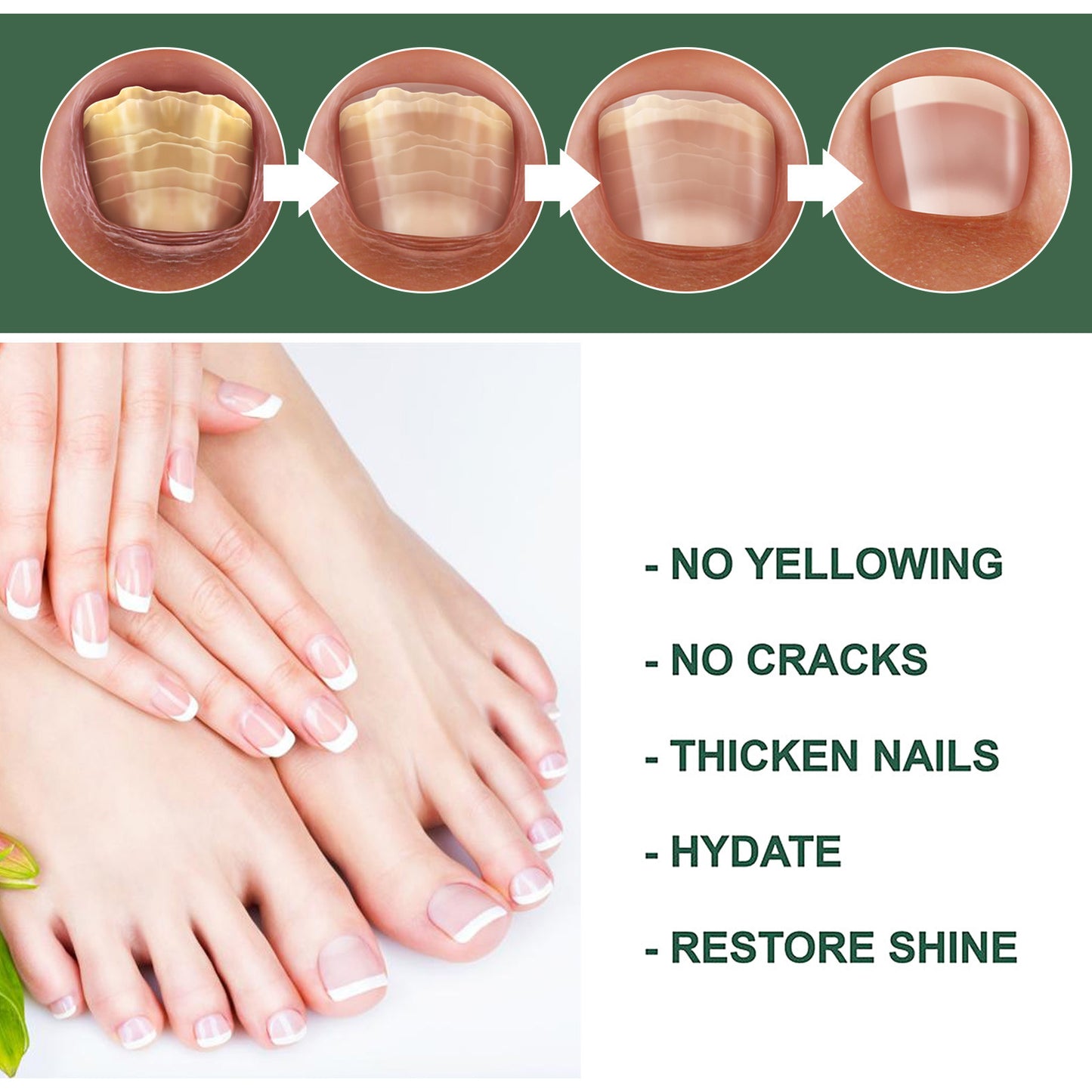 Foot Care Solution Onychomycosis Nail Care Solution