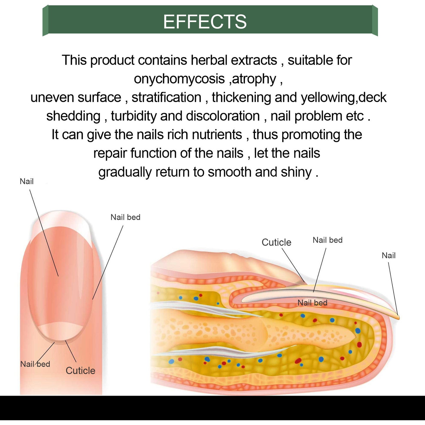 Foot Care Solution Onychomycosis Nail Care Solution